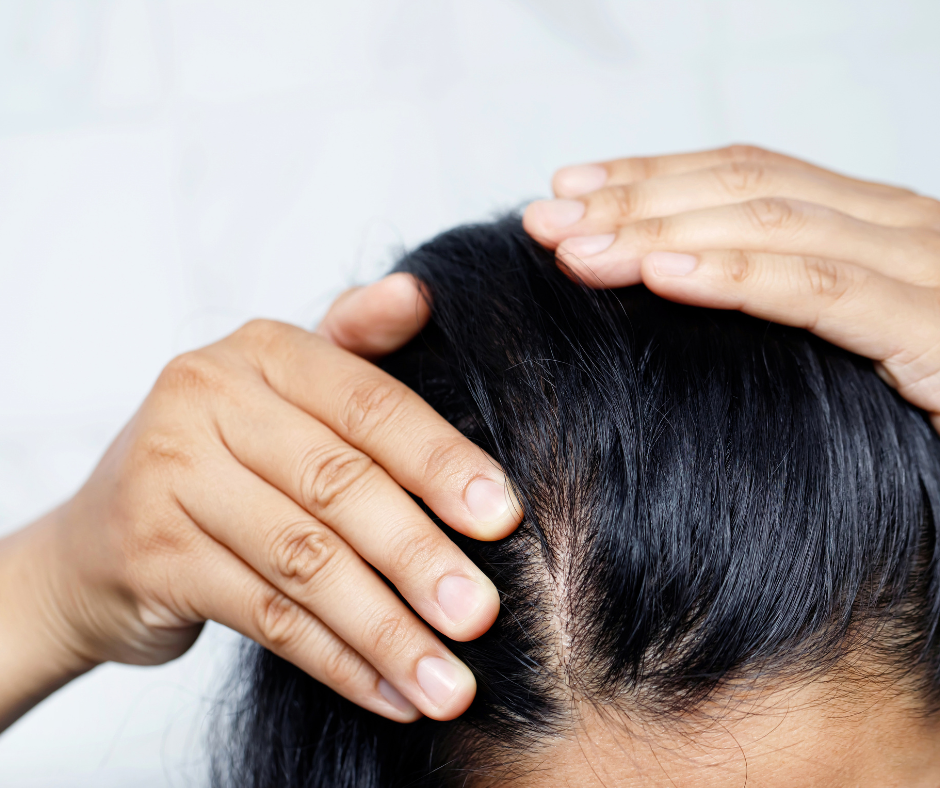 a person touching their scalp to reveal hair loss